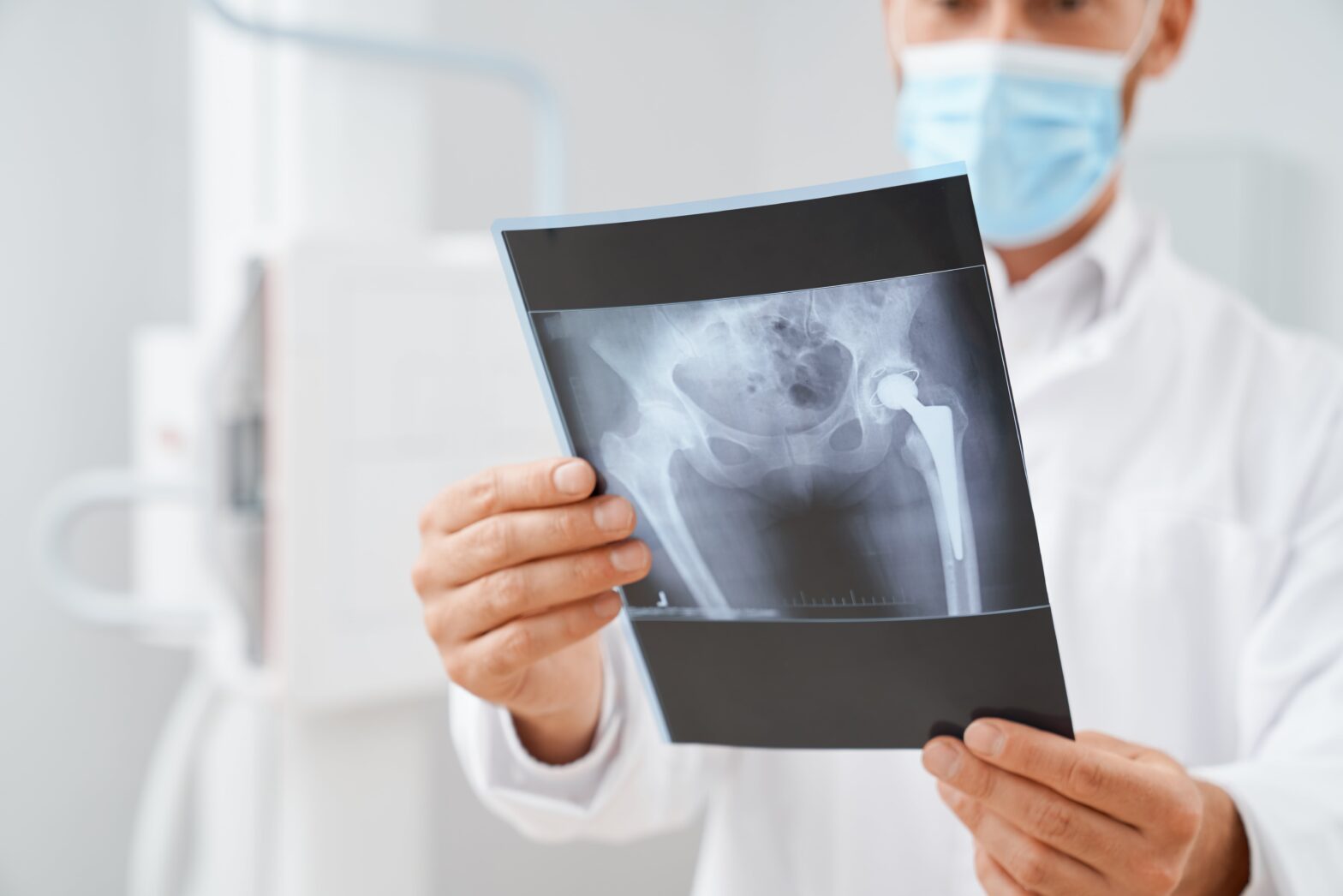 x-ray of a hip injury from hit and run