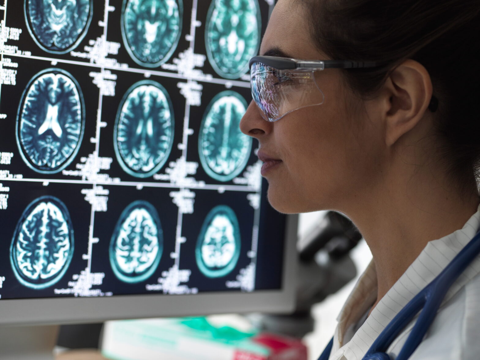 traumatic brain injuries