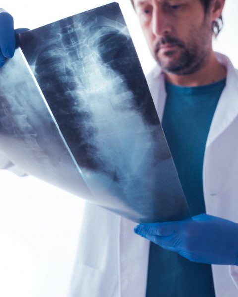 Doctor examining x-ray of the human spine