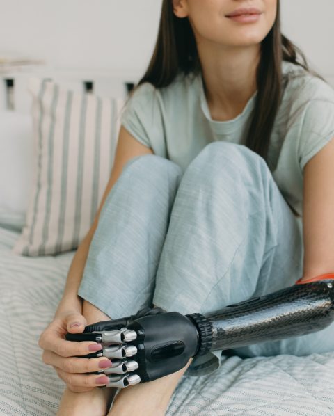 Crop shot of artificial 3d-printed iron metal black hand holding legs of Caucasian woman sitting on bed. Biomedical engineering. Rehabilitation. Technological progress and lifestyle